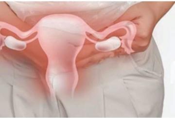 Causes, symptoms and treatment of uterine prolapse in women Causes, symptoms and treatment of uterine prolapse in women